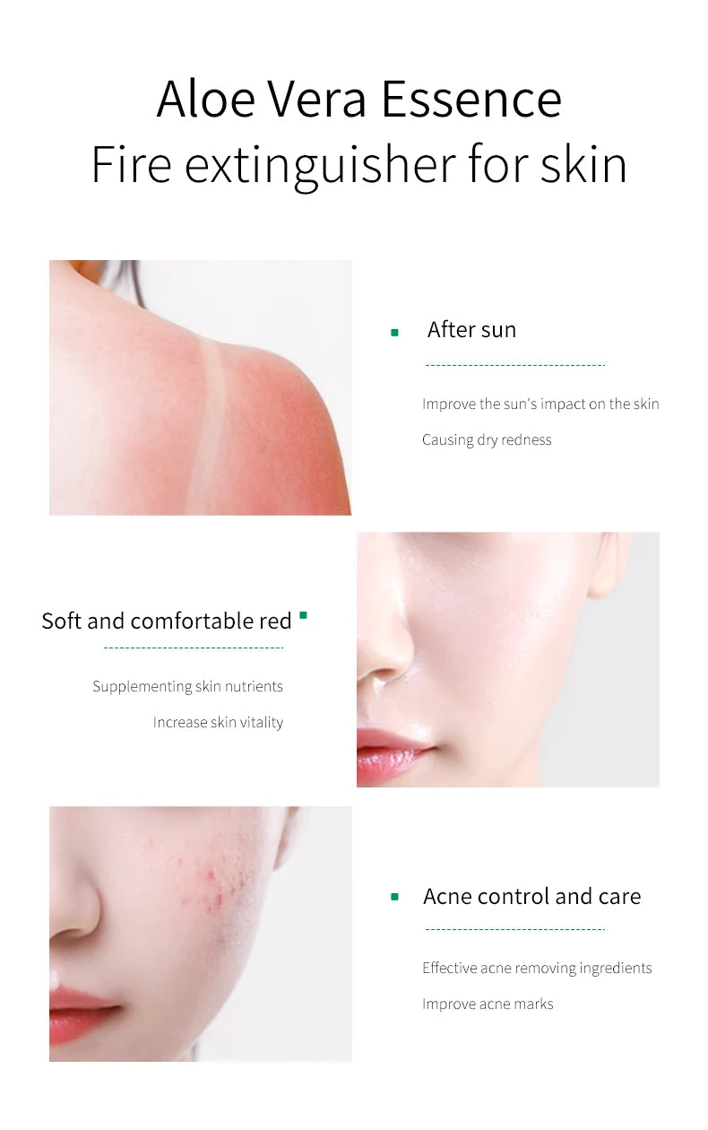 FONCE Organic Pure Aloe Vera Gel 300g Moisturizing Cream Sunburn Aloe Gel Natural Safe Sleeping Mask Soothing Lotion