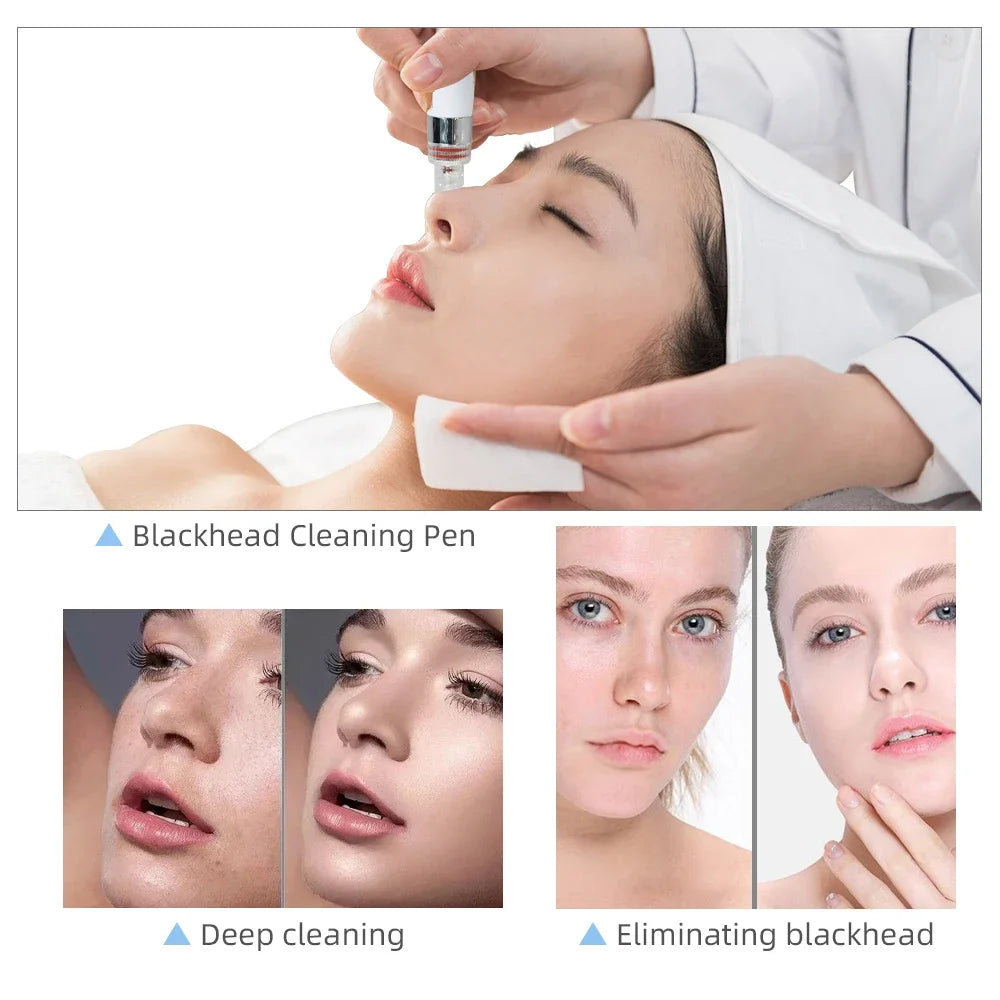 Missheart Professional Beauty Facial Machine Hydra Aqua Deep Cleaning Skin Care Device( EU /UK /US Fast Shipping)