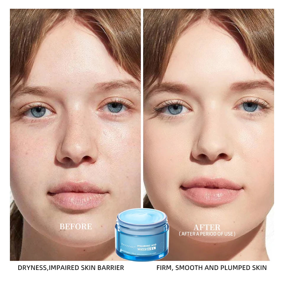 Hydro Boost Hyaluronic Acid Hydrating Face Moisturizer Gel-Cream to Hydrate and Smooth Extra-Dry Skin