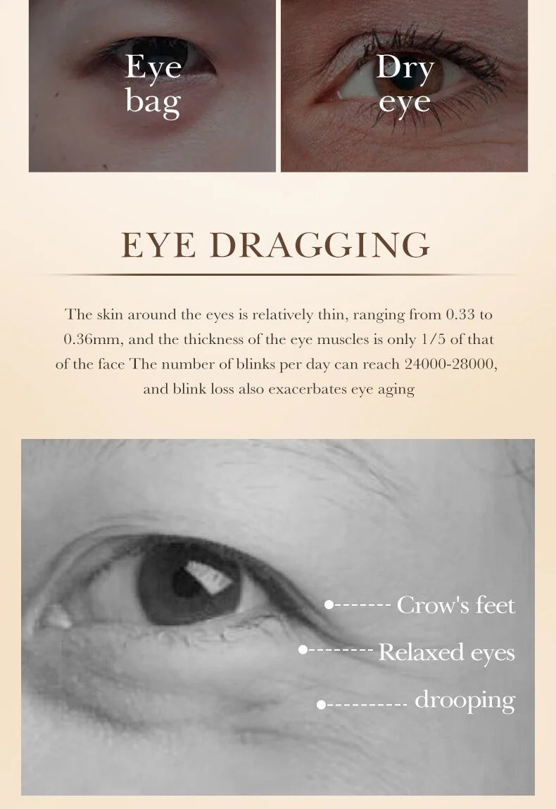 SADOER Caviar Collagen Eye Cream Anti Dark Circles Removal Eye Bags Nourishing Moisturizing Firming Eyes Skin Care Proudcts