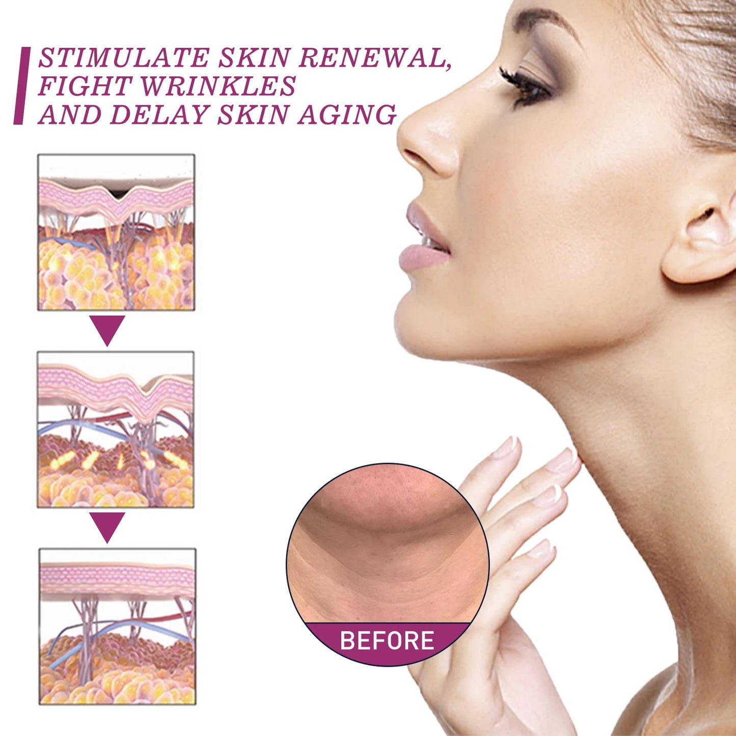 Hydrolyzed Collagen Neck Cream Eliminate Neck Fine Lines Firming Lifting Neck Remove Double Chin Rejuvenation Cream SkinCare