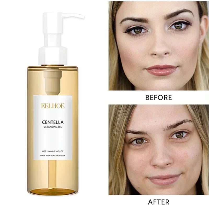 Centella Asiatica Makeup Remover Lightweight Refreshing And Gentle Face Cleansing Oil Lip And Eye Cosmetic Removal Cleaning