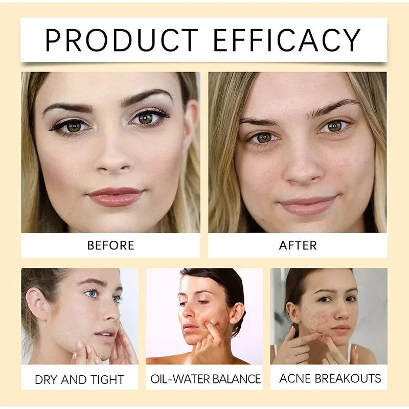 Centella Asiatica Makeup Remover Lightweight Refreshing And Gentle Face Cleansing Oil Lip And Eye Cosmetic Removal Cleaning