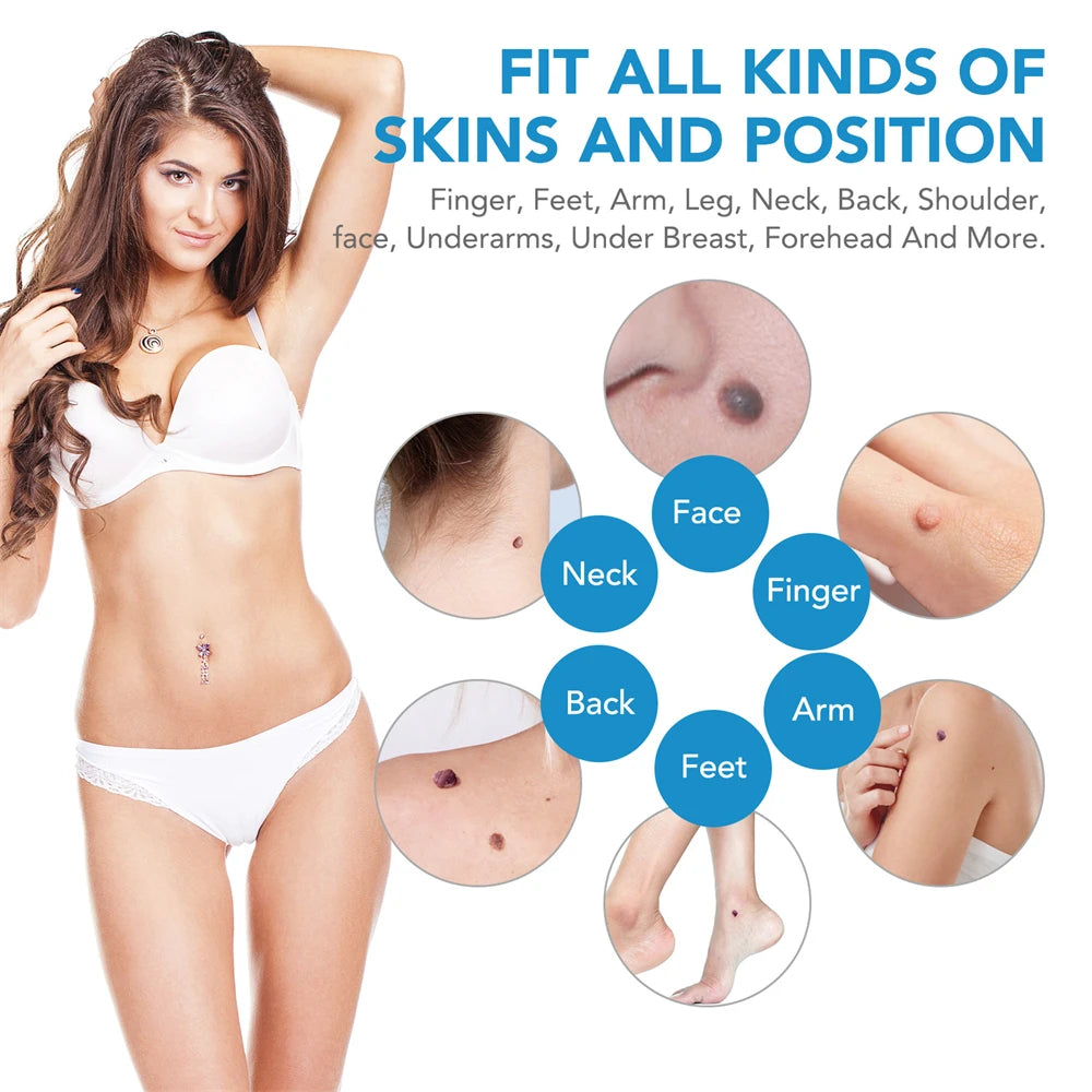 2 IN 1 Auto Micro Skin Tag Remover Device Standard And Micro Skin Tag Removal Kit Adult Mole Wart Remover Face Care Beauty Tools